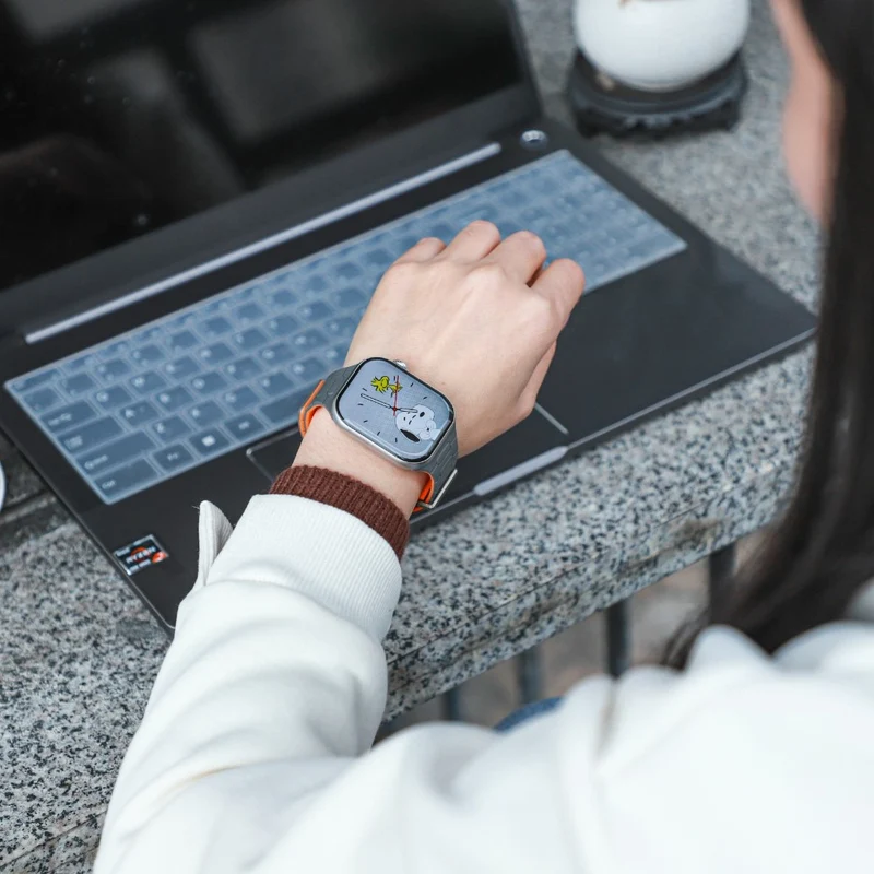 Unglaublich Süß Apple Smartwatch Silikon Universell Armband