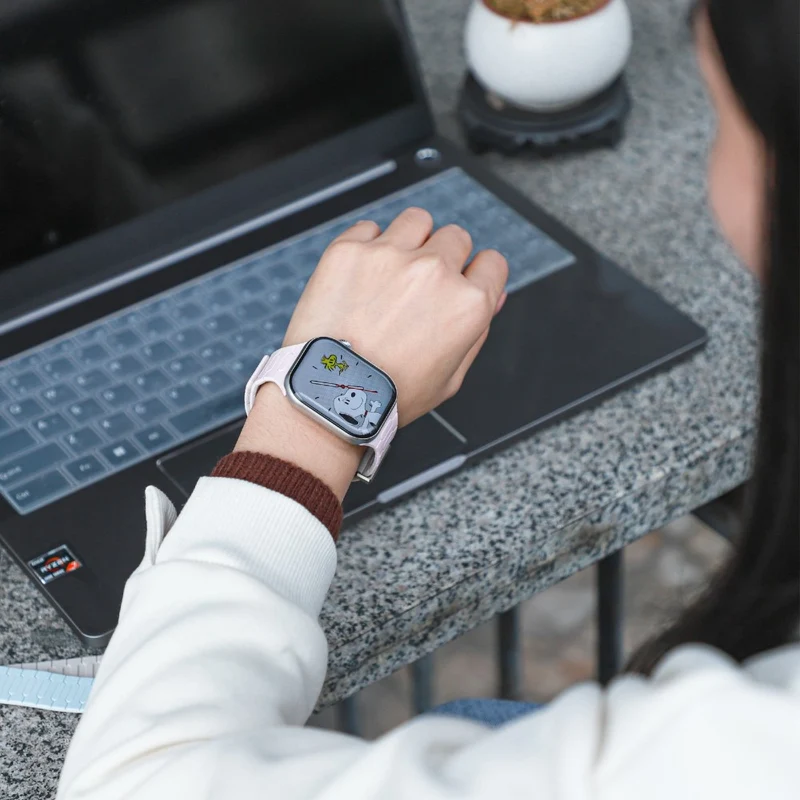 Unglaublich Süß Apple Smartwatch Silikon Universell Armband