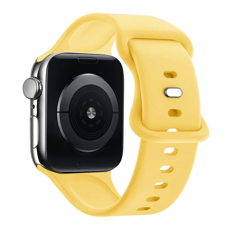 xoxo Wildhearts Apple Watch Silikonarmband (Gelb)
