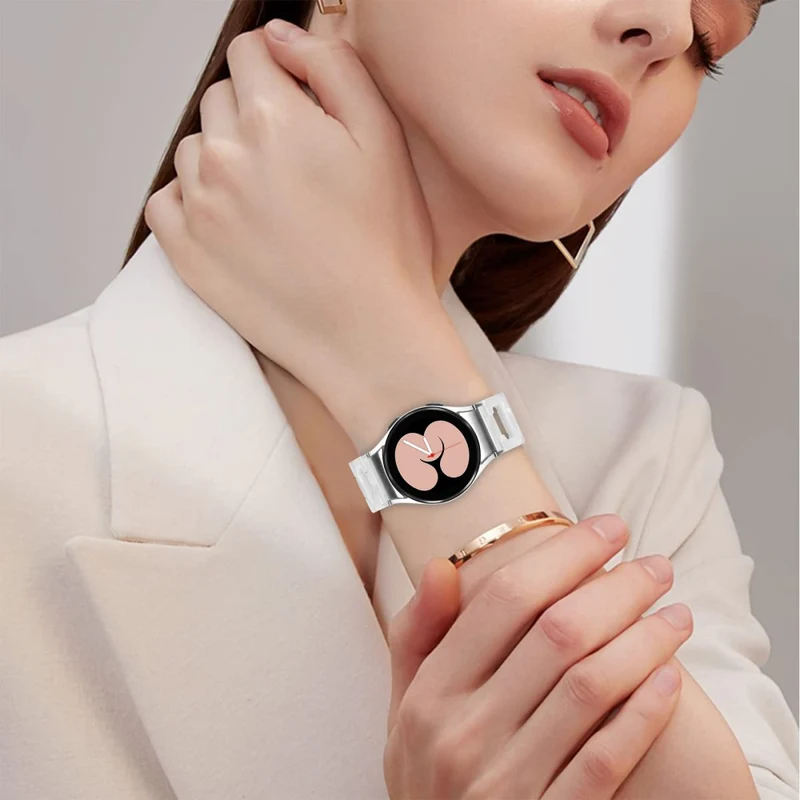 Unglaublich schönes Samsung Smartwatch Kunststoff Universel Armband